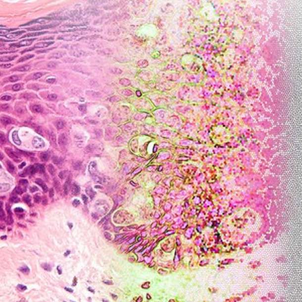 Berlin- Plattform für KI in der Diagnostik