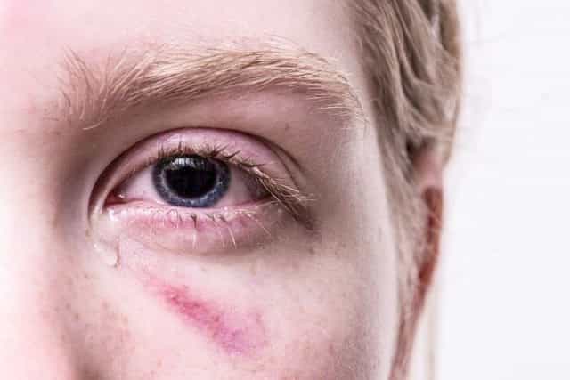 Eskalation Trier – 40 Menschen attackieren Polizei